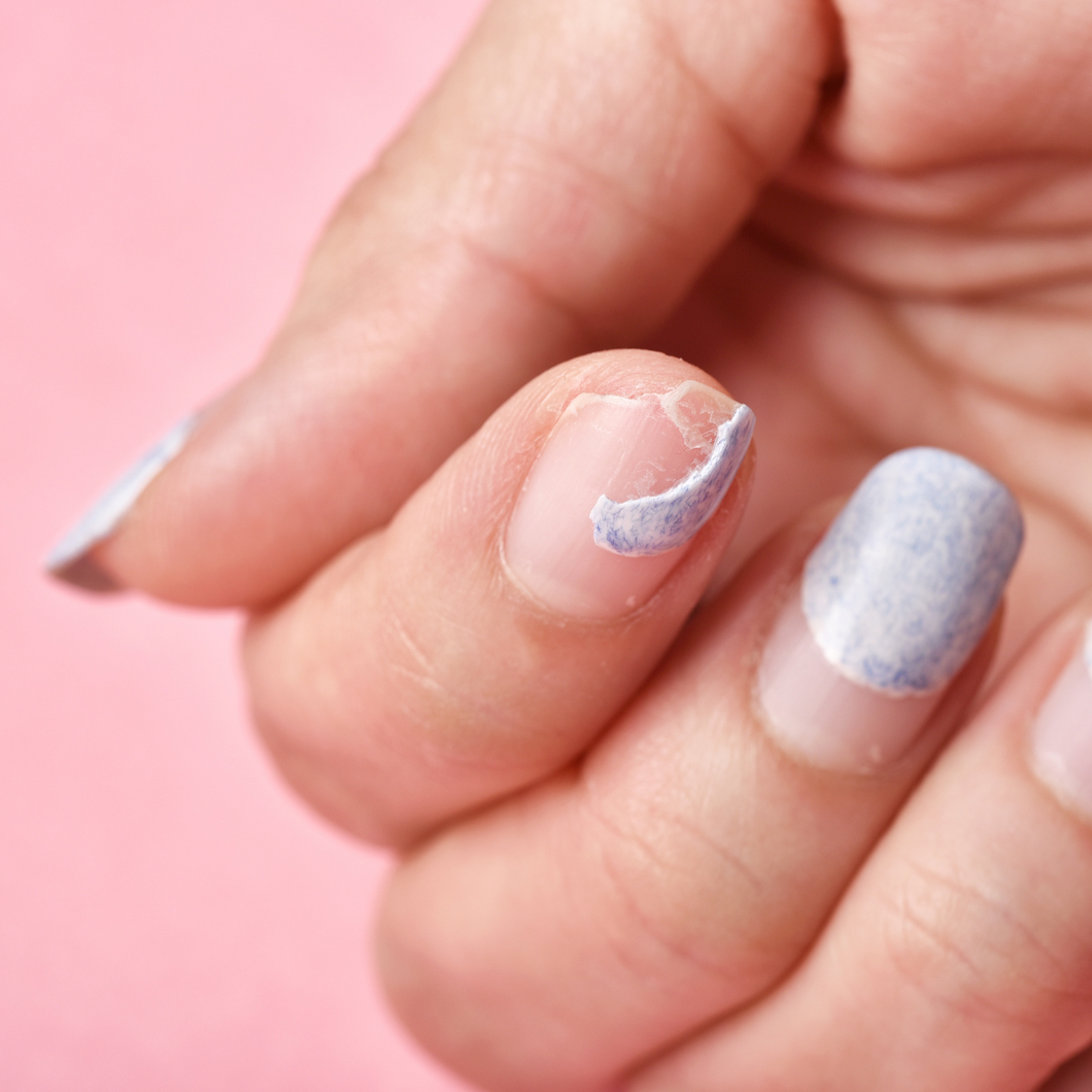 Réparation d'un ongle