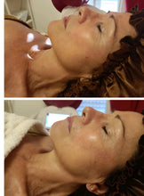 Nouveau Hydradermie 1000